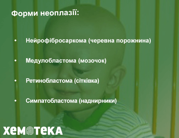 Класифікація