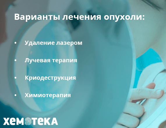 Варианты лечения опухоли